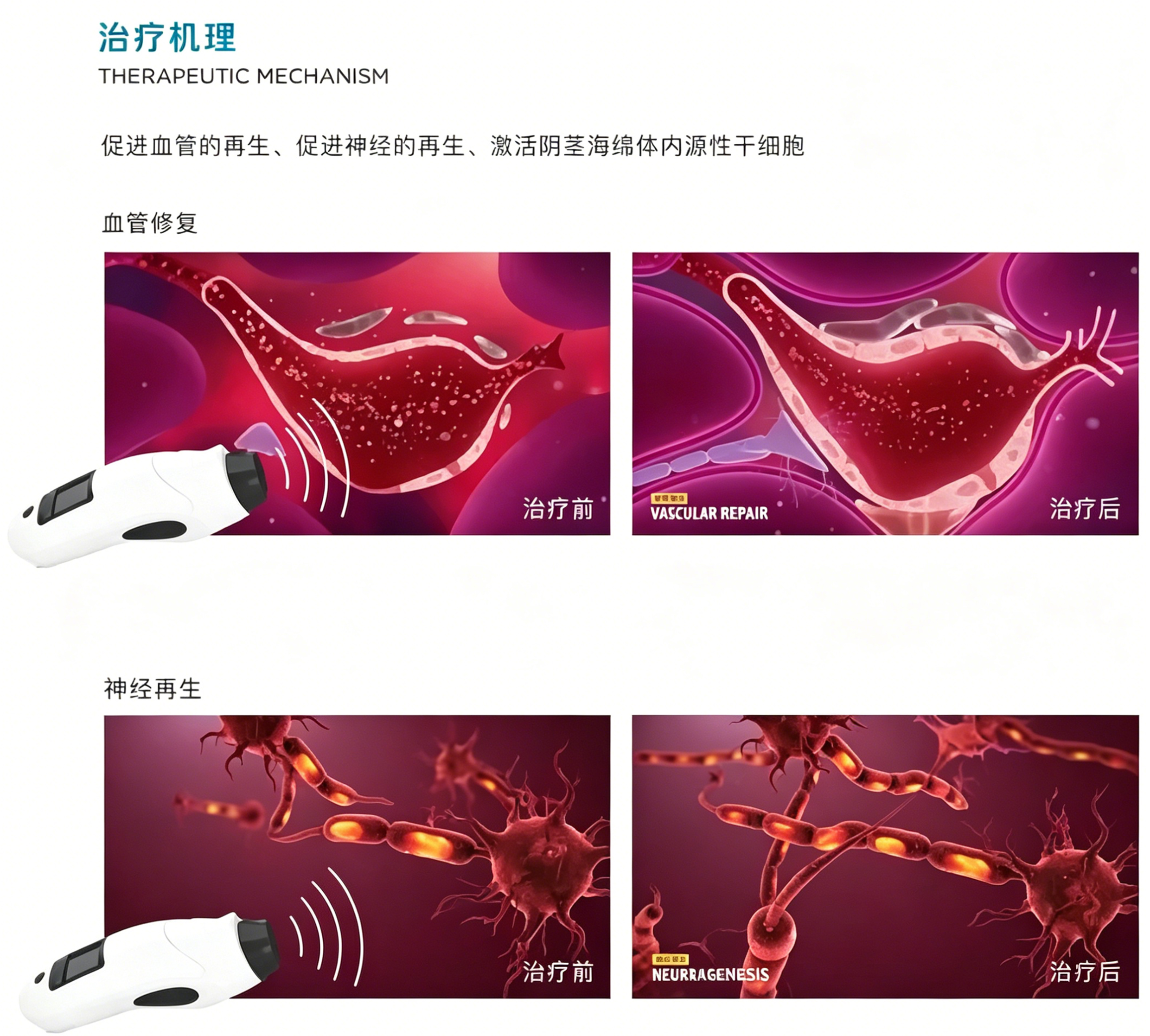 1787799146586526.jpg 治疗机理.jpg