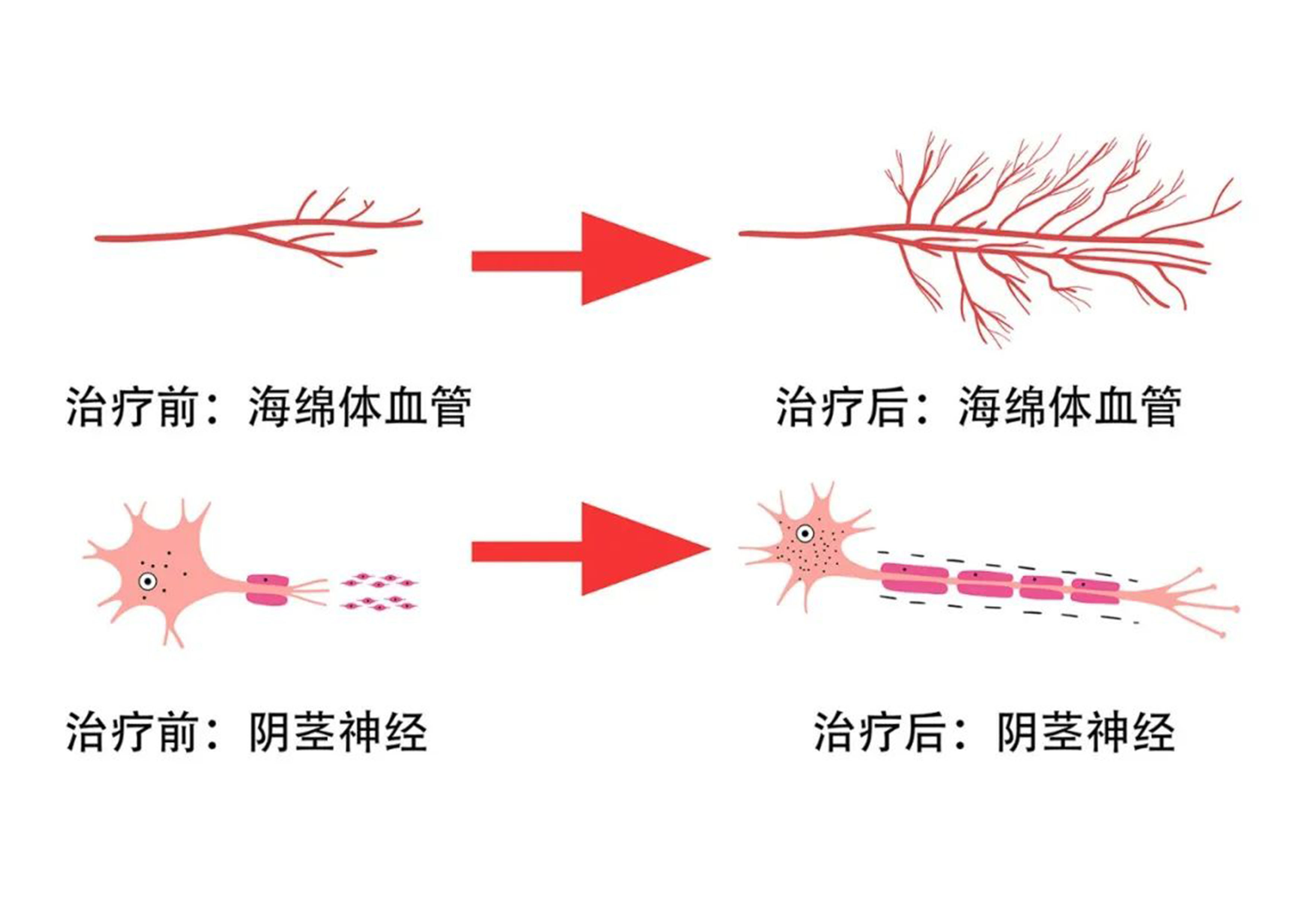 1787799157407303.jpg 治疗前后 中文版.jpg